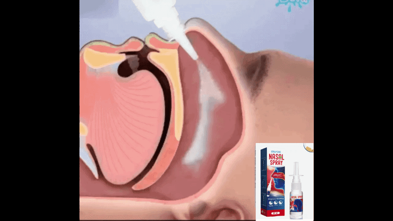 Spray naturel 3 en 1 anti-sinusite-purification des poumons et anti-ronflement