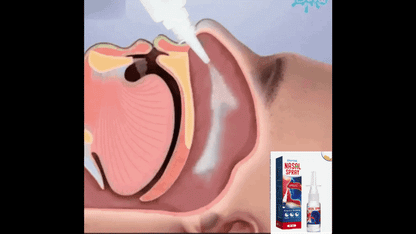 Spray naturel 3 en 1 anti-sinusite-purification des poumons et anti-ronflement