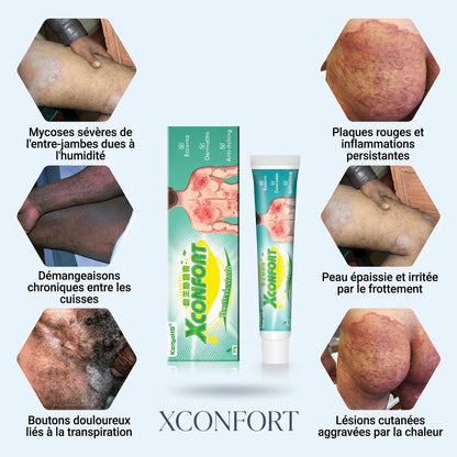 Crème Traitement Testé-5 Ans d'Infection Disparue en 7 Jours